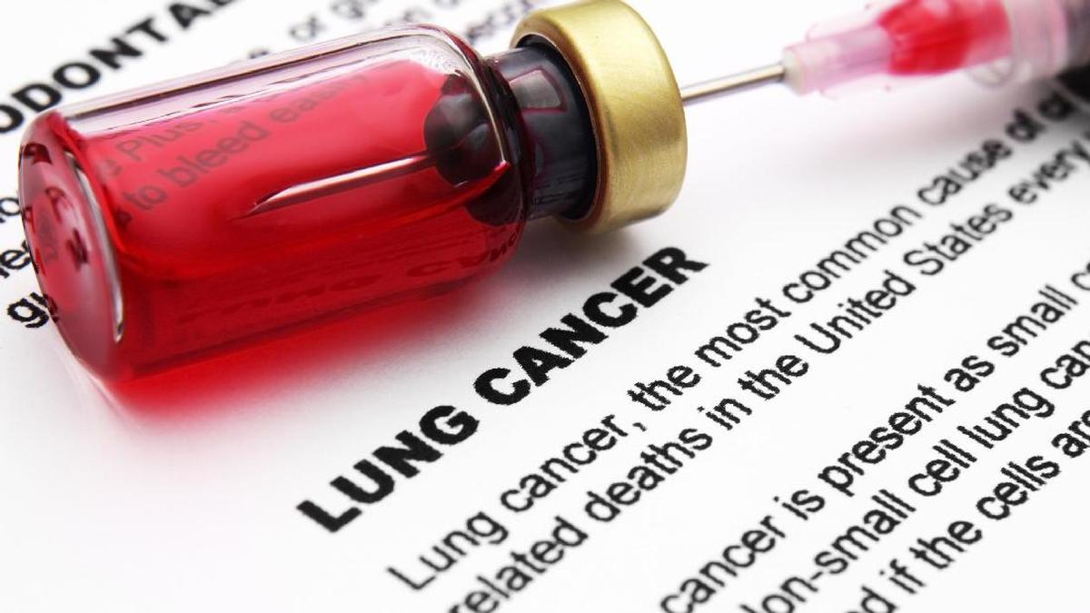 Berapa Lama Harapan Hidup Pasien Kanker Paru Stadium 4?