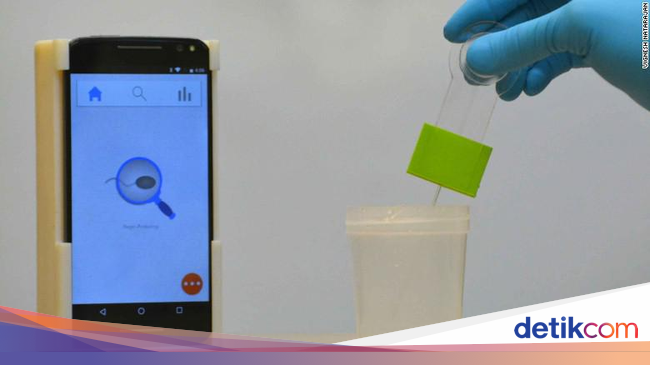 8 Penyebab Kehamilan Lewat Waktu Yang Perlu Diwaspadai