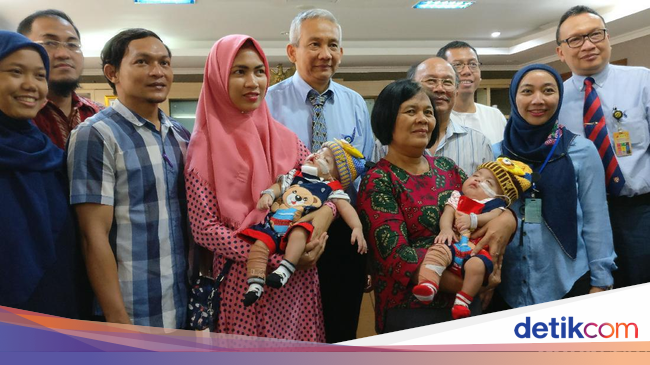 Usai Operasi, Bayi Kembar Siam Rifky-Rafky Sudah Bisa Pulang