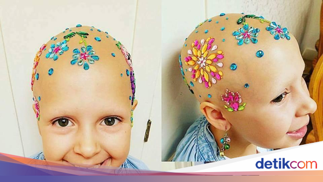Anak Perempuan Ini Buktikan Bisa Tetap Cantik dengan Anak Perempuan Ini Buktikan Bisa Tetap Cantik dengan