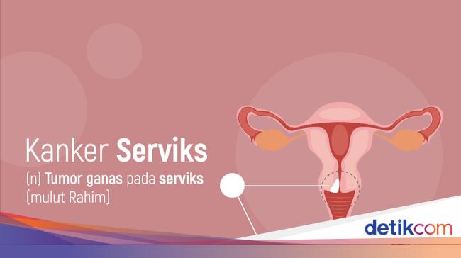 Ini Kisaran Biaya Vaksin Hpv Penangkal Kanker Serviks Yang Mematikan Ini Kisaran Biaya Vaksin Hpv Penangkal Kanker Serviks Yang Mematikan