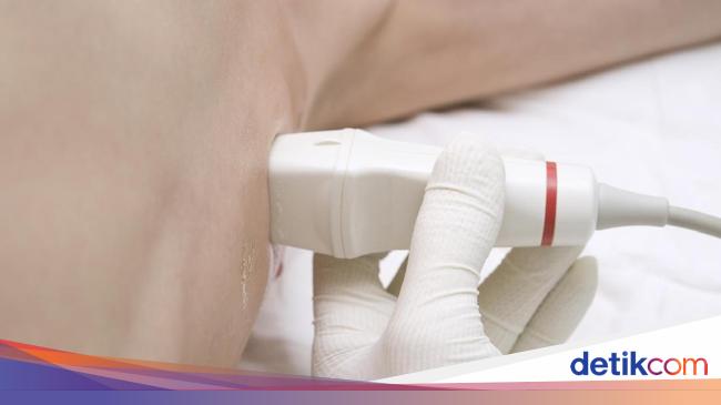 Pengangkatan Benjolan Payudara Pembedahan Umum Gleneagles Hospital