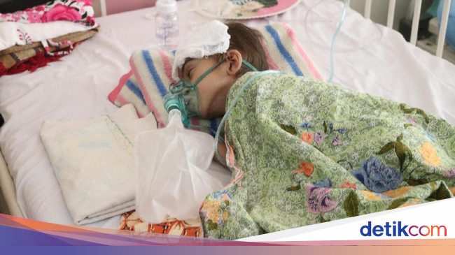 Kasihan, Bocah 4 Tahun di Aceh Alami Bocor Jantung dan 