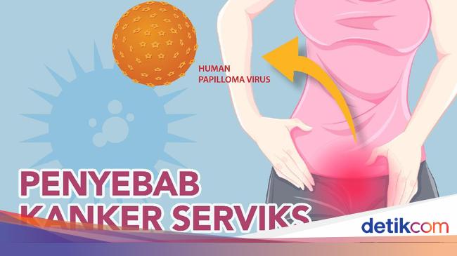 jenis hpv yang menyebabkan kanker serviks