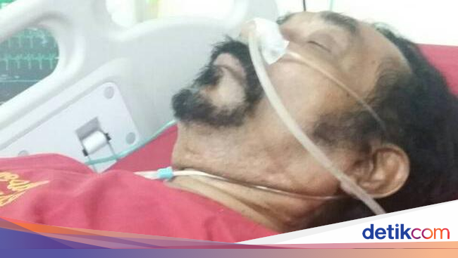 Hamdan ATT Alami Serangan Jantung dan Ada Pembuluh Darah 