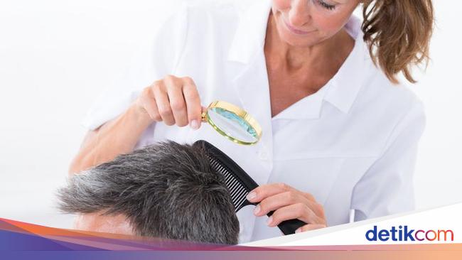 10 Cara Menghilangkan Kutu Rambut dengan Cepat dan Alami