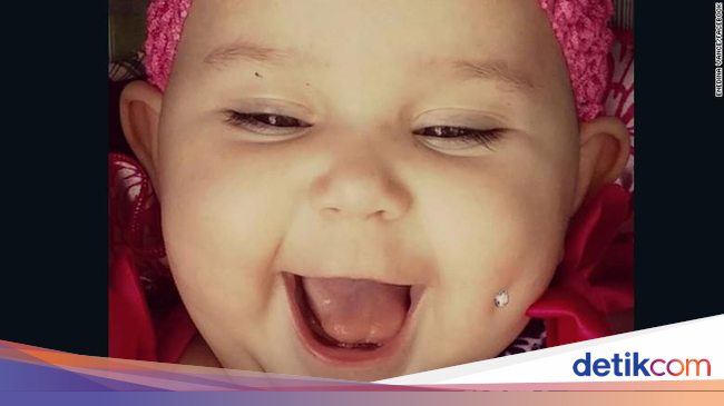 Foto Bayi yang Pipinya Ditindik Ini Memicu Kontroversi Foto Bayi yang Pipinya Ditindik Ini Memicu Kontroversi