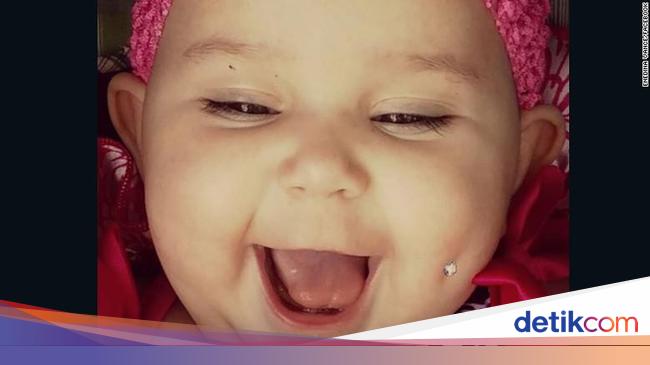 Foto Bayi Yang Pipinya Ditindik Ini Memicu Kontroversi