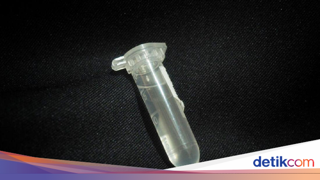 stapler operasi bpjs untuk Lem Operasi Jantung Unair Inovasi Ciptakan Mahasiswa stapler operasi bpjs untuk Lem Operasi Jantung Unair Inovasi Ciptakan Mahasiswa