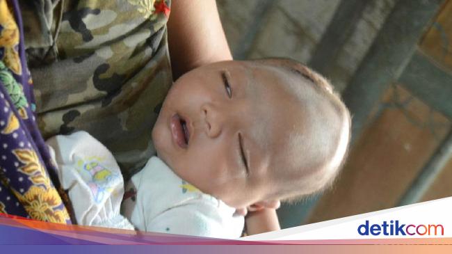 Keluarga Bayi Kenzo Tak Salahkan Dukun Pijat Bayi