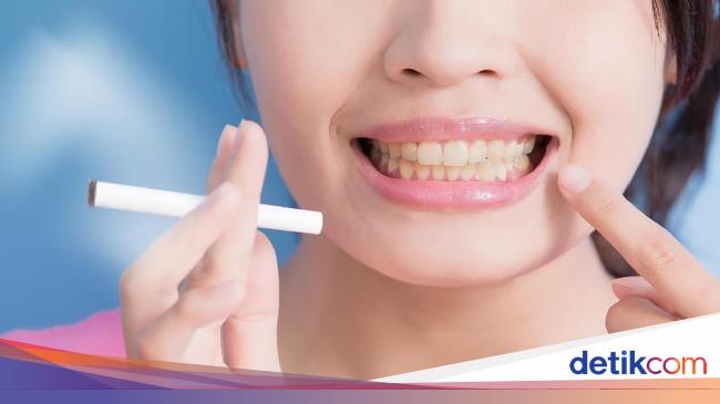 8 Penyebab Gigi Menjadi Kuning Mulai Dari Merokok Hingga Minum Kopi