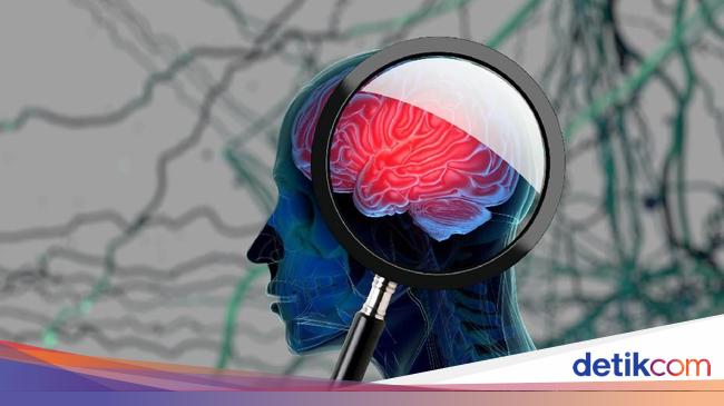 Studi Ungkap Hal Sepele Ini Ternyata Bisa Bikin Pikun