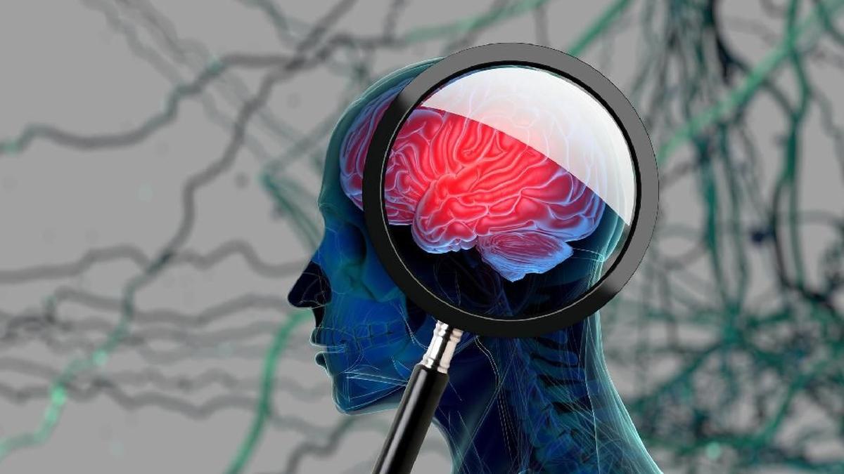 Mendadak Jadi Pelupa? Begini Membedakan Otak Lemot gegara Umur dan Demensia