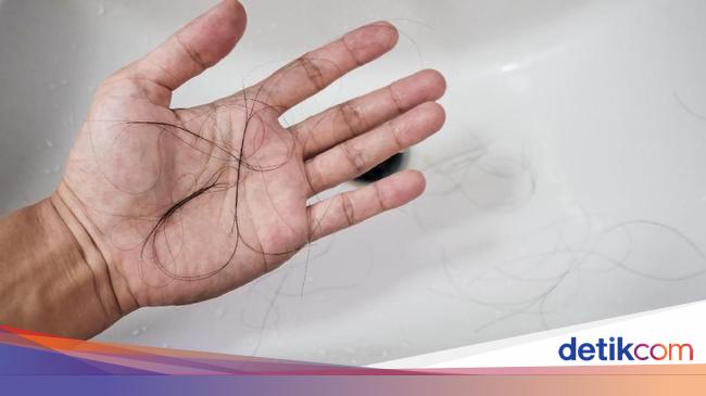 Hindari Makanan Ini Supaya Rambut Tidak Rontok Hindari Makanan Ini Supaya Rambut Tidak Rontok
