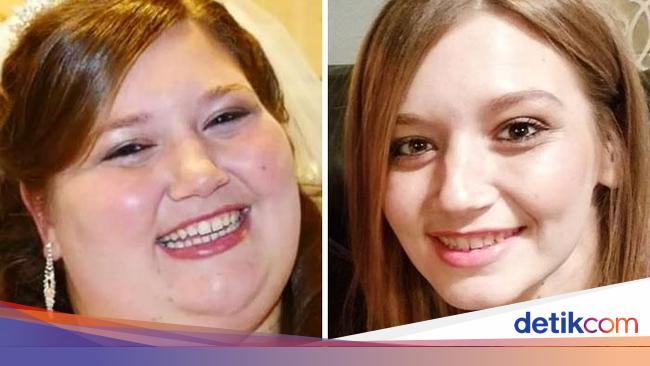 15 Transformasi Wajah Wanita Pasca Berat Badan Turun Drastis Beda Banget 15 Transformasi Wajah Wanita Pasca Berat Badan Turun Drastis Beda Banget