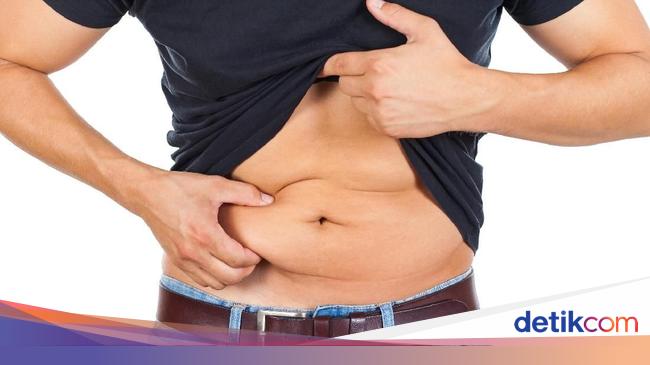 Perut Buncit Karena Lemak Vs Kembung Ini 4 Perbedaannya