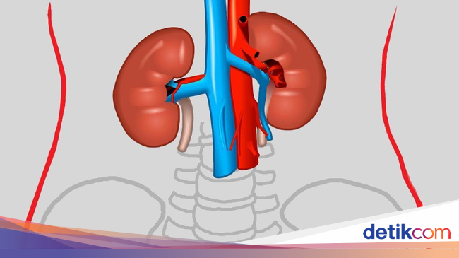 Kenali 5 Tanda Gagal Ginjal 