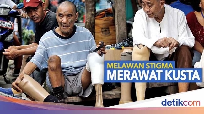 Berbagai Mitos tentang Kusta yang Harus Diketahui