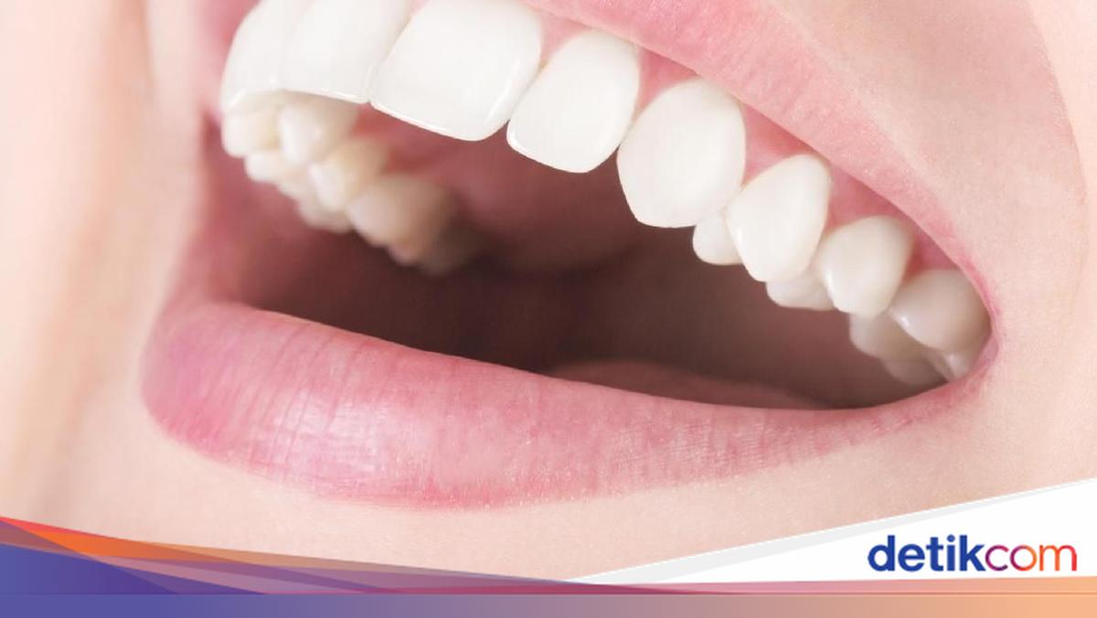Gigi Gak Rapi Alasan Pentingnya Punya Gigi Rapi dan Rata Menurut Dokter Gigi