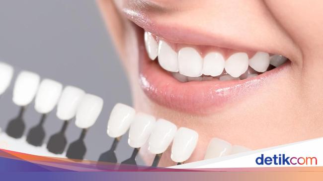 Viral Di Tiktok Tren Pakai Produk Pemutih Berbahaya Di Gigi