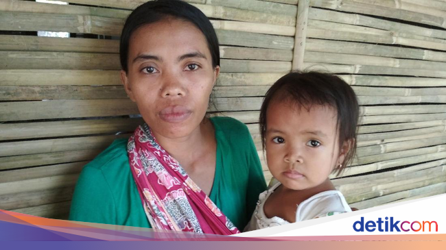 4 Dampak Besar Masalah Stunting Anak Bila Dibiarkan