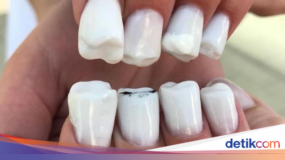 Yay or Nay? Hiasan Kuku Bentuk Gigi yang Bikin Merinding Melihatnya
