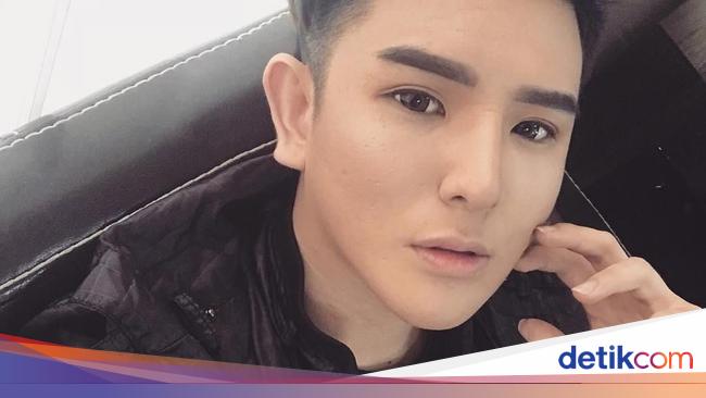 Jadi Ganteng Penampilan Pria Yang Operasi Plastik Setelah Diputusin Pacar