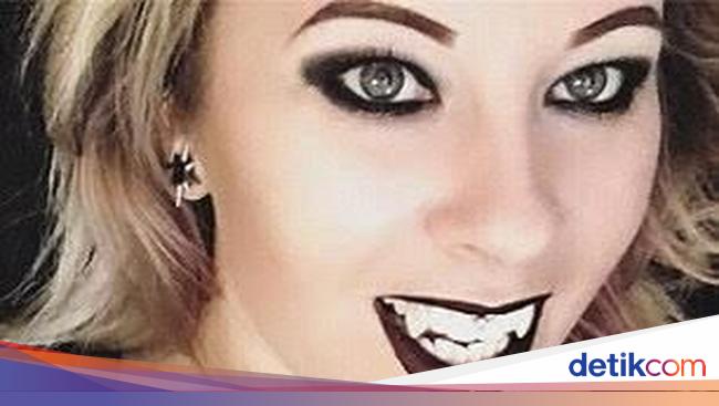 Terobsesi Jadi Vampir, Wanita Ini Selalu Pakai Gigi Taring ...