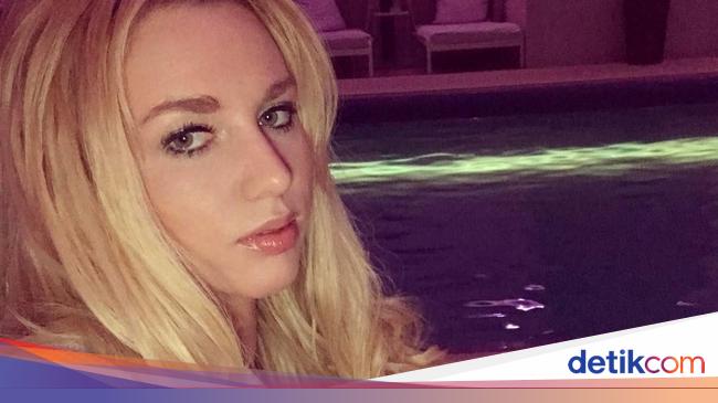 Potret Anna Shapiro, Model Seksi Rusia yang Mengaku Diracun Vladimir Putin