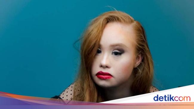 Ini Model Down Syndrome Pertama Yang Bermimpi Tampil Untuk Victorias 