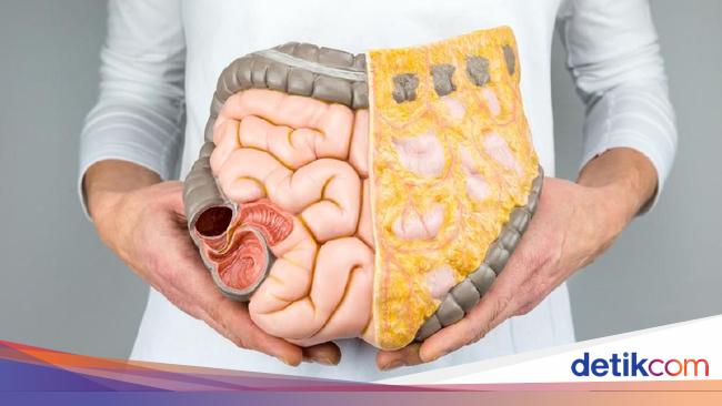 Cases of colon cancer at a young age are increasing, be aware of the symptoms