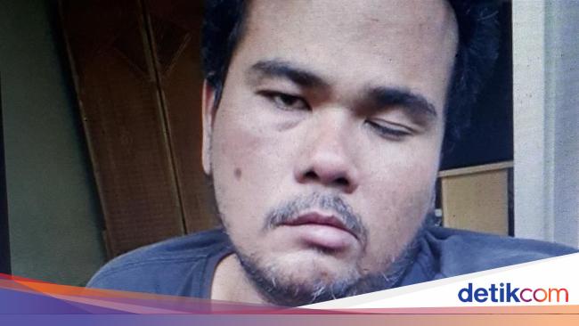 Seperti Fahmi Bo, 6 Artis Indonesia Ini Berjuang Hadapi Serangan Stroke