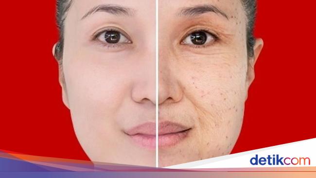 Cara Menghilangkan Jerawat di Wajah dalam Satu Minggu