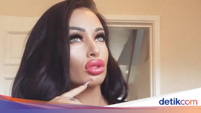 Penampilan Ava Wanita yang Obsesi Implan Payudara Meski 