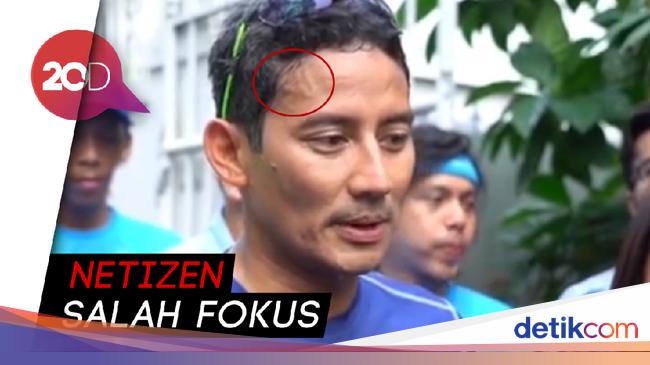 Kenapa Saat Olahraga Muncul Urat Seperti Di Dahi Sandiaga Uno