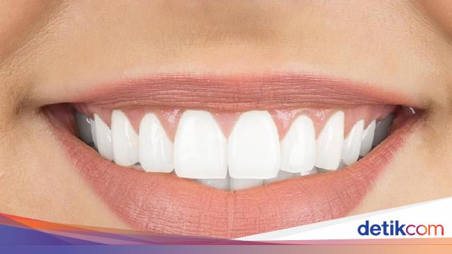 17 Cara Memutihkan Gigi Kuning Secara Alami 17 Cara Memutihkan Gigi Kuning Secara Alami