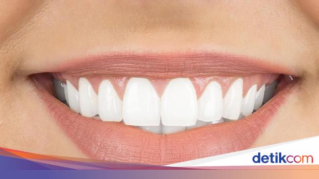17 Cara Memutihkan Gigi Kuning Secara Alami