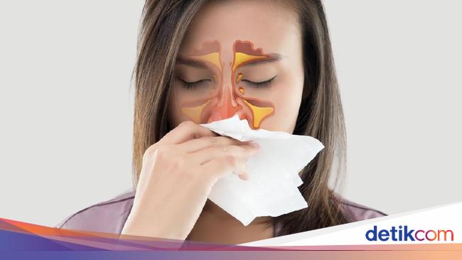 Often mistaken for the common cold, recognize the 4 symptoms of sinusitis to watch out for