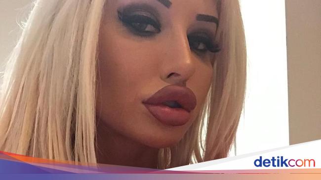 Punya Dada Jumbo dan Bibir Tebal Wanita Ini Disumpahi Punya Dada Jumbo dan Bibir Tebal Wanita Ini Disumpahi