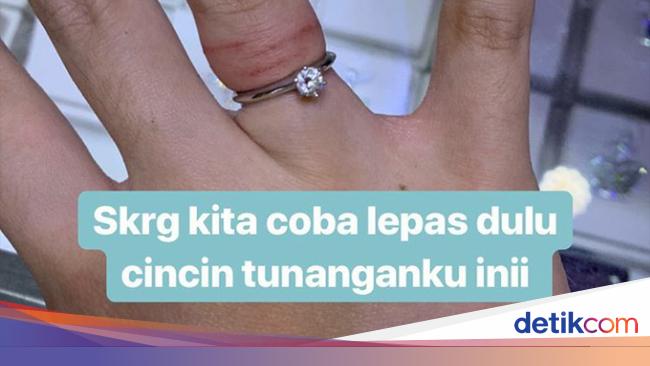 Paling Populer 13+ Gambar Tangan Pake Cincin - Gani Gambar