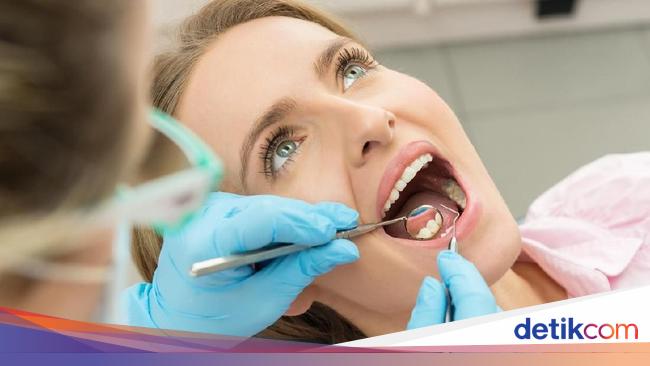 Scaling Gigi Dianjurkan 6 Bulan Sekali Ini Fakta Faktanya Scaling Gigi Dianjurkan 6 Bulan Sekali Ini Fakta Faktanya