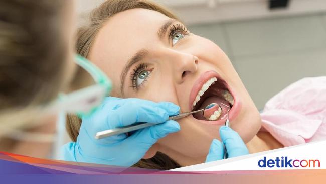 Scaling Gigi Dianjurkan 6 Bulan Sekali Ini Fakta Faktanya Scaling Gigi Dianjurkan 6 Bulan Sekali Ini Fakta Faktanya