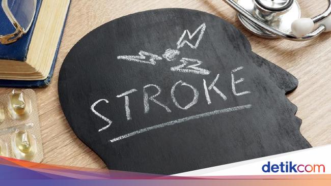 Can Minor Stroke Be Cured?  This is what the cardiologist says