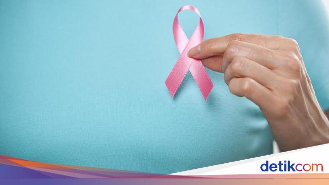 Cerita Wanita yang Idap Kanker Payudara Stadium 4 di Usia 22 Tahun