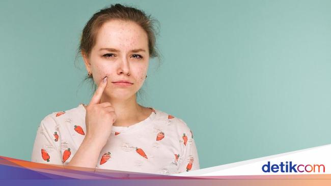 5 Bahan Aktif dalam Produk Skincare yang Ampuh