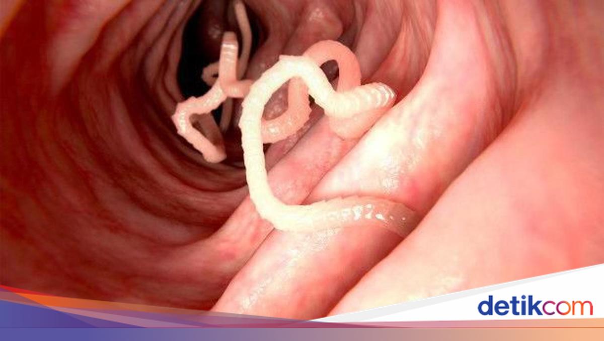 Kenali 5 Cacing dan Bakteri yang Sering ‘Bersembunyi’ di Makanan Kenali 5 Cacing dan Bakteri yang Sering ‘Bersembunyi’ di Makanan