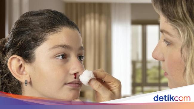 Understanding Nosebleeds: Types, Symptoms, and Causes