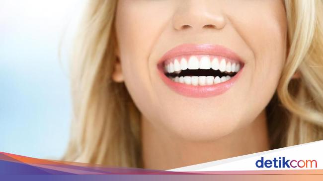 13 Cara Memutihkan Gigi Secara Alami, Tak Perlu Veneer!