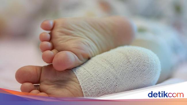 Viral Kaki Balita 2 Tahun Patah Usai Kejepit Eskalator Mal di Jakbar