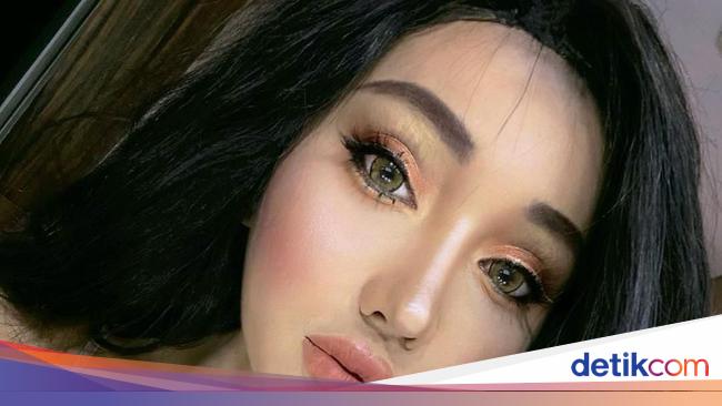 Lucinta Luna Ganti Kelamin di Thailand, Ini Prosedur Operasi Ganti Kelamin
